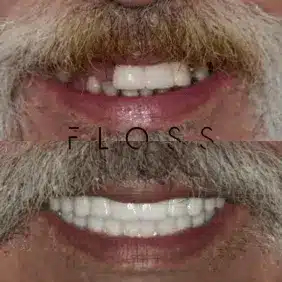 befor-after image