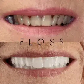 befor-after image