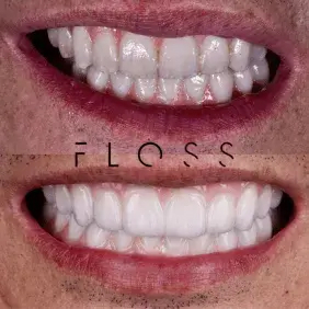 befor-after image