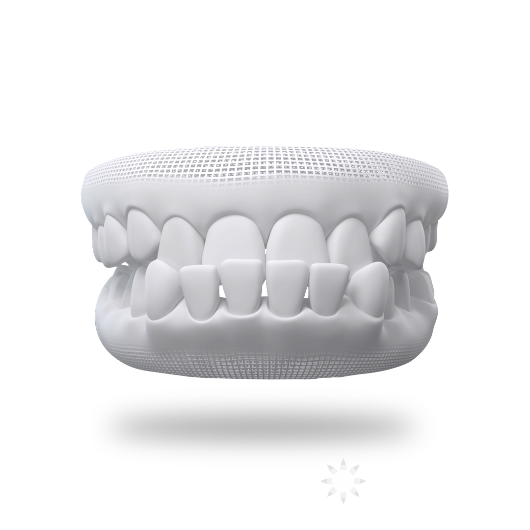 Underbite Teeth
